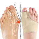 Bunion Corrector – OrthoLine